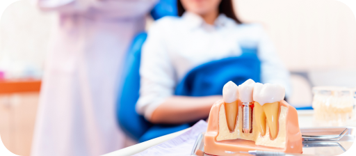 Dental implant replacing a missing tooth compared with a traditional dental bridge