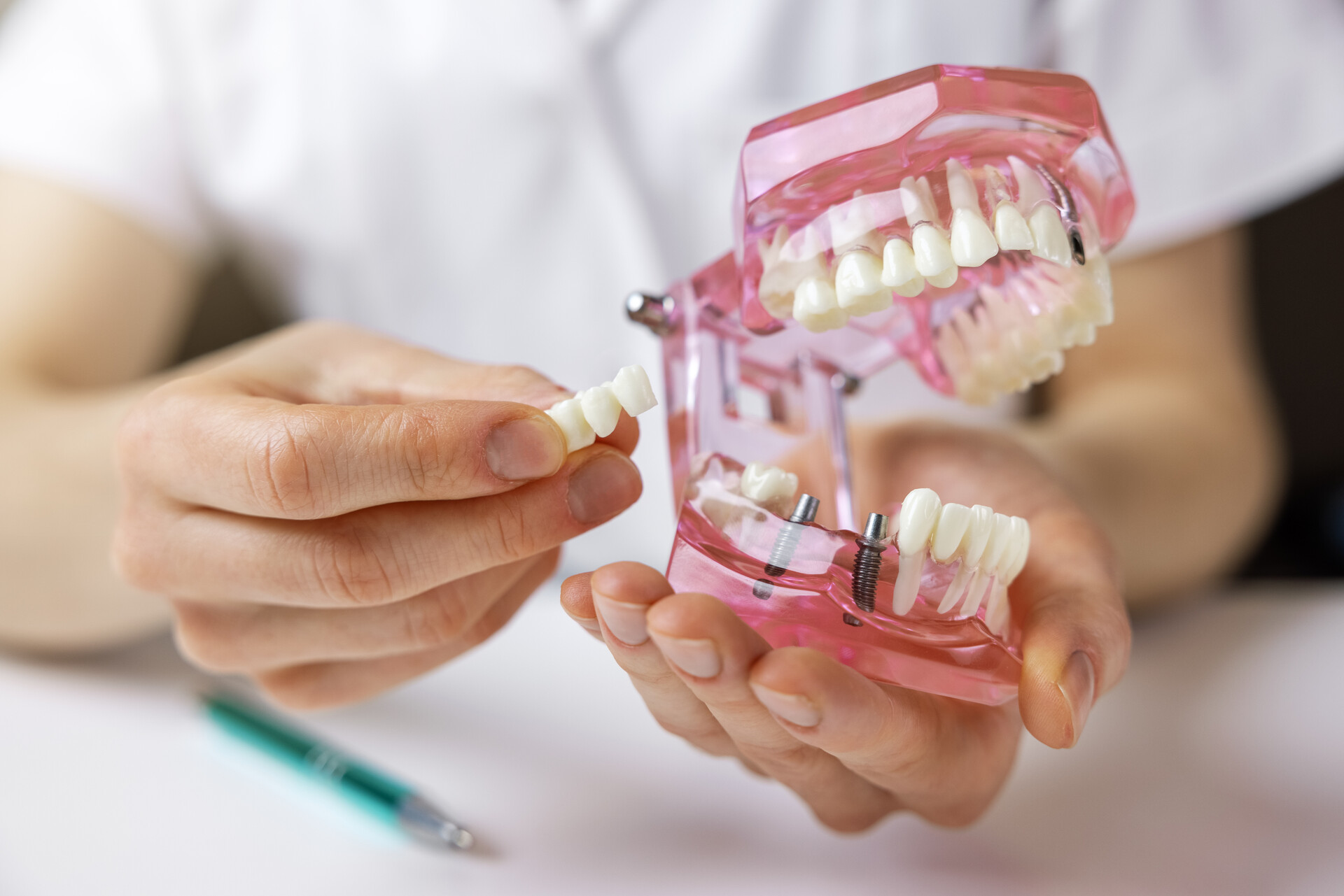 A person holding model teeth with implants