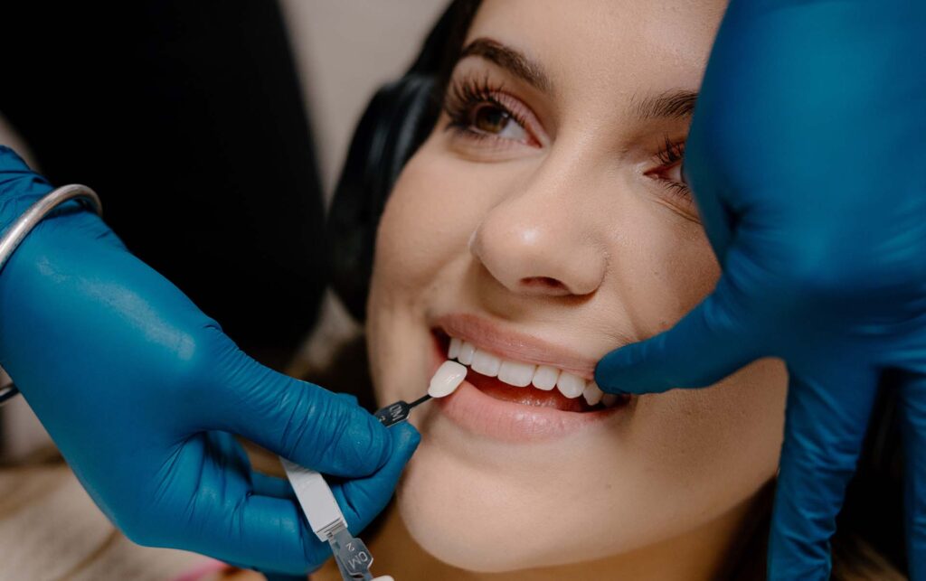  A dentist testing different enamel shades on a patient