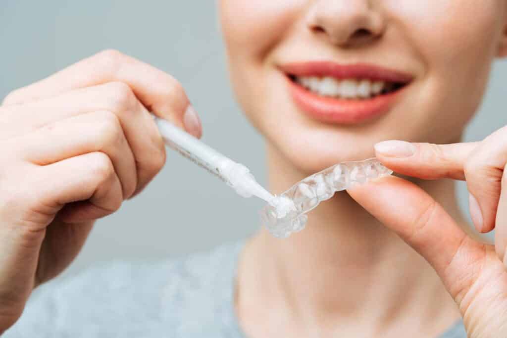 A young woman does a home teeth whitening procedure. Whitening tray with gel.