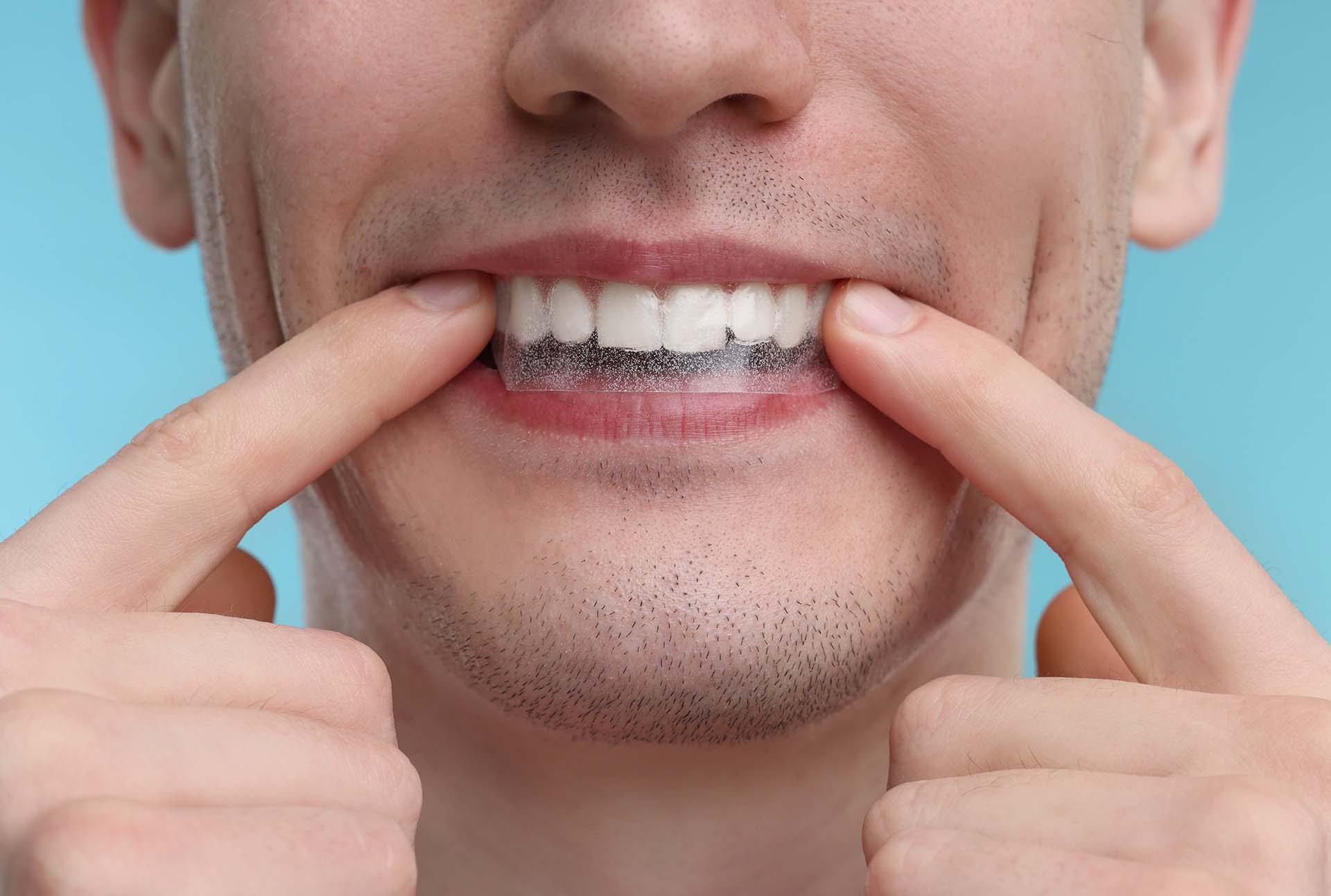 Young man applying whitening strip on his teeth against light blue background, closeup