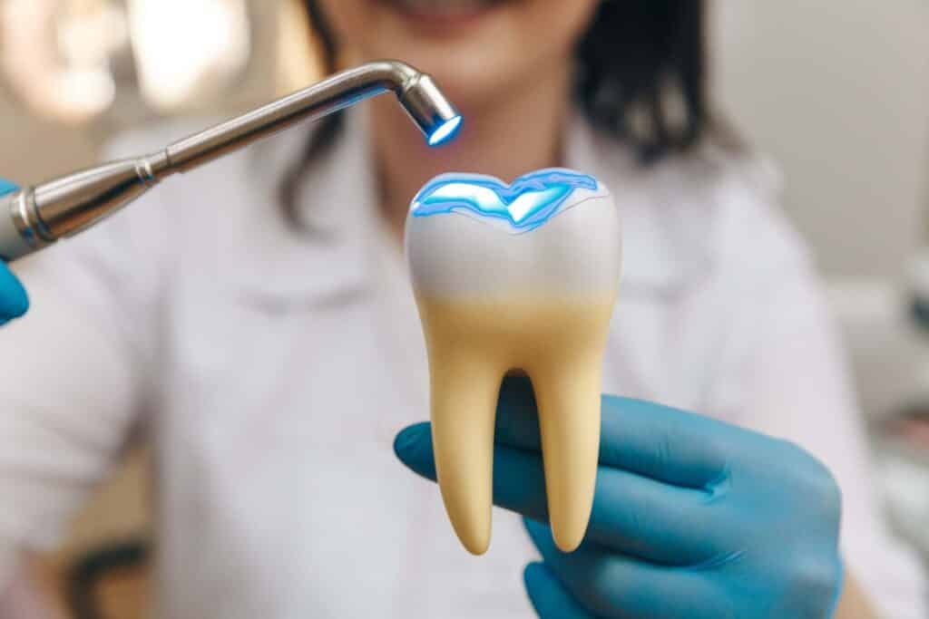 Process of filling on fake tooth