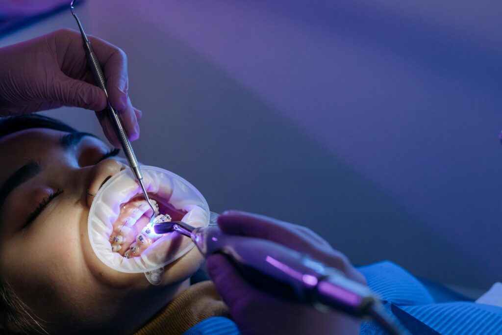 Dentist performing laser-activated teeth whitening treatment on patient with protective mouth retractor and UV light