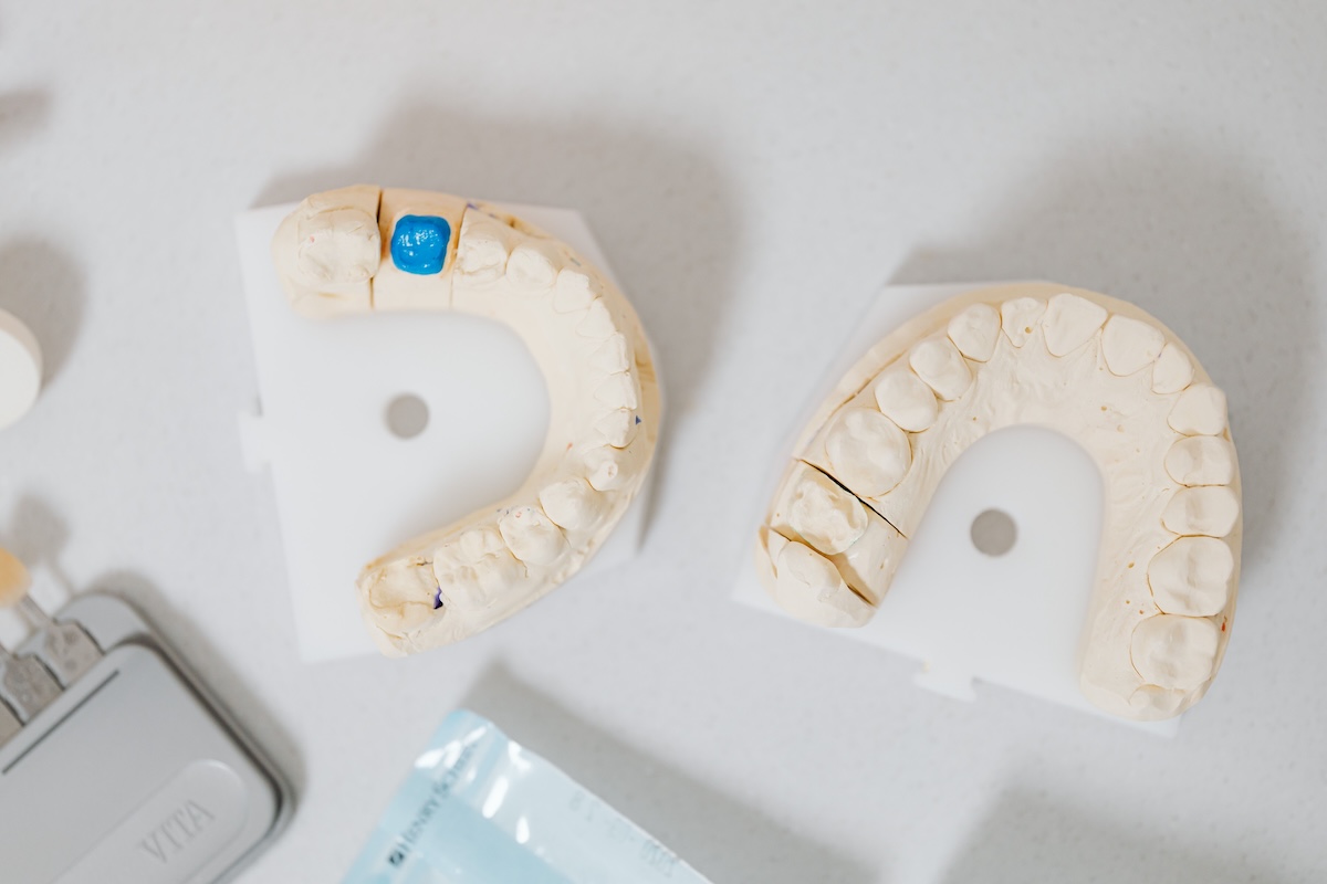 Dental crown impression models with shade guide at Aspire Dental Wellness